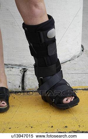 Stock Photography - Close up of person wearing a walking cast.. Fotosearch