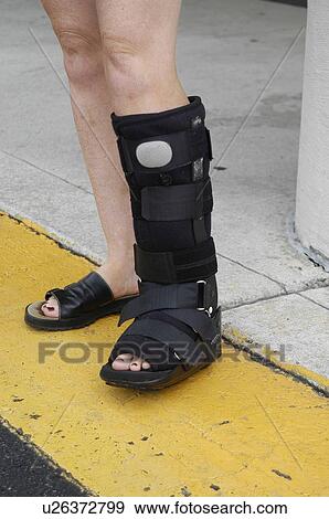 Stock Photo - Close up picture of a person wearing a walking cast.. Fotosearch