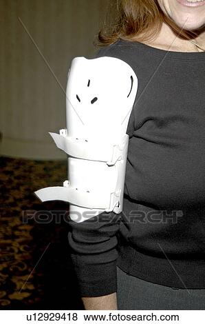 Stock Photo - Smiling young woman with a plastic arm brace secured to her right arm with Velcro straps.. Fotosearch