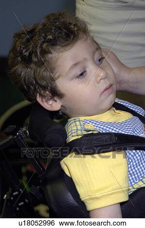 Stock Photograph - Close up of a little boy with significant disabilities.. Fotosearch