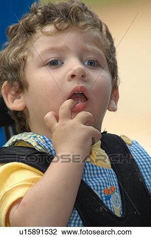 Stock Image - Interesting expression/face of a little boy with multiple disabilities.. Fotosearch