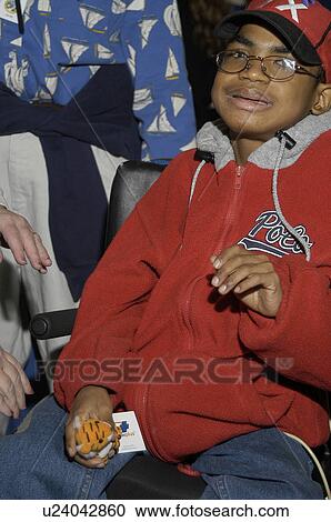 Stock Image - Little boy with multiple disabilities posing for the camera.. Fotosearch
