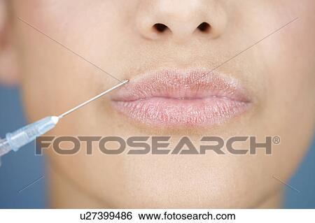 A young woman having a collagen injection View Large Photo Image Stock Photograph - A young woman having a collagen injection. Fotosearch