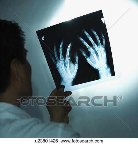 Asian American male doctor examining x-rays. View Large Photo Image Stock Photograph - Asian American male doctor examining x-rays.. Fotosearch