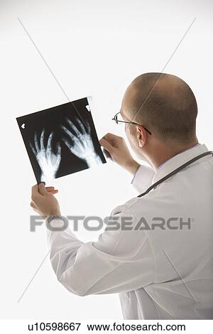 Stock Photo - Caucasian mid adult male physician holding up hand xrays.. Fotosearch