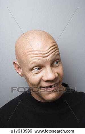 Stock Photograph - Male with missing tooth.. Fotosearch