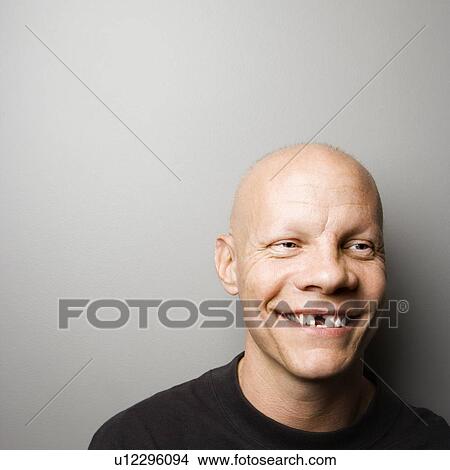 Portrait of mid-adult Caucasian male with missing tooth. View Large Photo Image Picture - Portrait of mid-adult Caucasian male with missing tooth.. Fotosearch