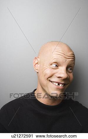 Portrait of mid-adult Caucasian male with missing tooth. View Large Photo Image Stock Image - Portrait of mid-adult Caucasian male with missing tooth.. Fotosearch