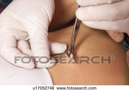Close up of skin held in piercing tool as needle is ready to go in to pierce naval. View Large Photo Image Stock Photo - Close up of skin held in piercing tool as needle is ready to go in to pierce naval.. Fotosearch