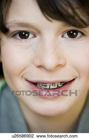 Portrait boy with brace View Large Photo Image Stock Image - Portrait boy with brace. Fotosearch
