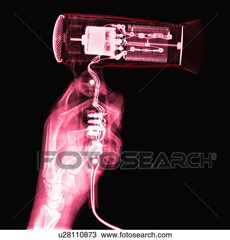 X-ray Image, Hair Dryer View Large Photo Image Stock Image - X-ray Image, Hair Dryer. Fotosearch