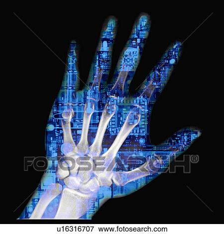 X-ray Image, Human Hand View Large Photo Image Stock Photo - X-ray Image, Human Hand. Fotosearch