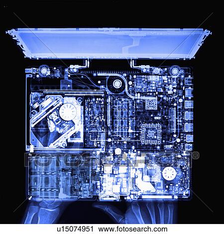 X-ray Image, Laptop View Large Photo Image Stock Image - X-ray Image, Laptop. Fotosearch