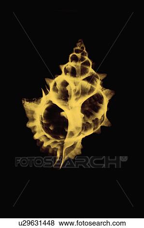X-ray Image, Shell View Large Photo Image Stock Photo - X-ray Image, Shell. Fotosearch