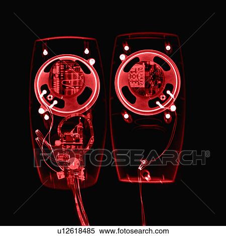 Stock Photography - X-ray Image, Speaker. Fotosearch