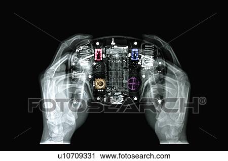 X-ray Image View Large Photo Image Stock Image - X-ray Image. Fotosearch