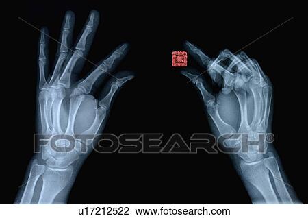 X-ray Image View Large Photo Image Stock Image - X-ray Image. Fotosearch