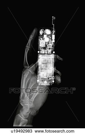 X-ray Image View Large Photo Image Stock Image - X-ray Image. Fotosearch