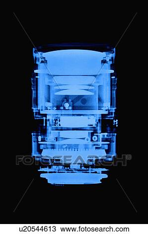 X-ray Image View Large Photo Image Stock Image - X-ray Image. Fotosearch