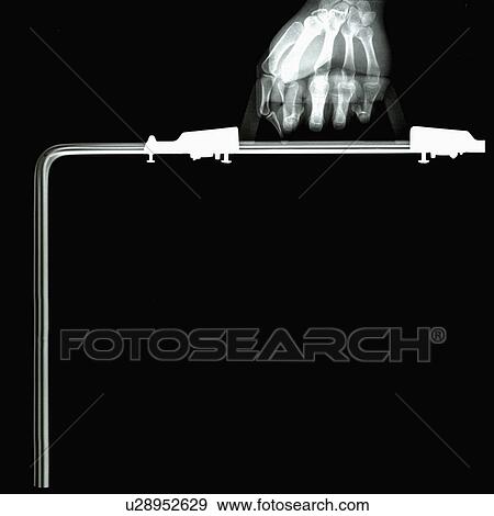Stock Photo - X-ray Image, Suitcase, Human Hand. Fotosearch