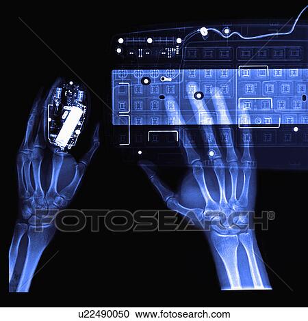 Stock Image - X-ray Image, using keyboard and computer mouse. Fotosearch