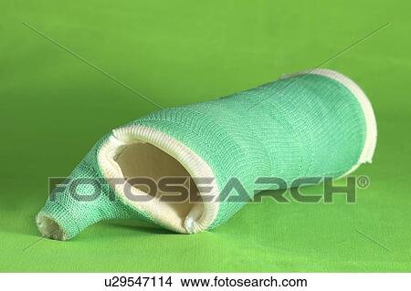 A removed cast View Large Photo Image Picture - A removed cast. Fotosearch
