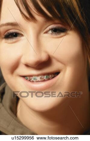 Stock Photograph - Girl with braces. Fotosearch