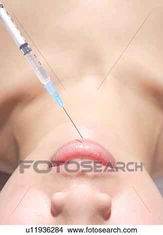 Woman gets collagen injections View Large Photo Image Picture - Woman gets collagen injections. Fotosearch
