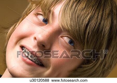 Stock Photo - Boy with braces on his teeth. Fotosearch