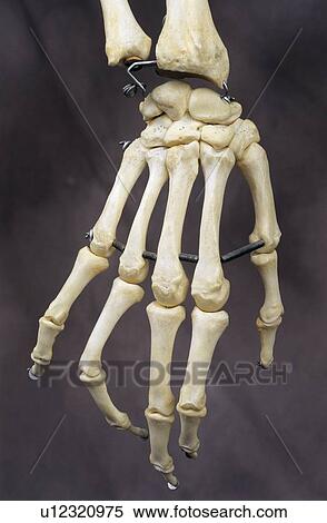 Human hand bones View Large Photo Image Stock Photography - Human hand bones. Fotosearch