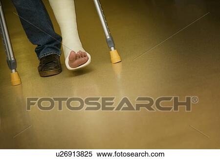 Walking with crutches View Large Photo Image Stock Photography - Walking with crutches. Fotosearch