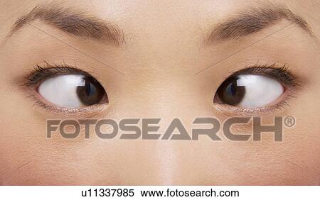 Cross-eyed woman close-up View Large Photo Image Stock Photography - Cross-eyed woman close-up. Fotosearch