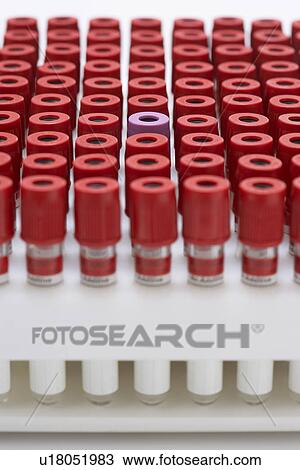 Stock Image - Test tubes with red lids surrounding one with purple lid. Fotosearch
