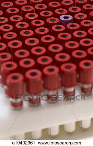 Stock Image - Test tubes with red lids surrounding one with purple lid. Fotosearch