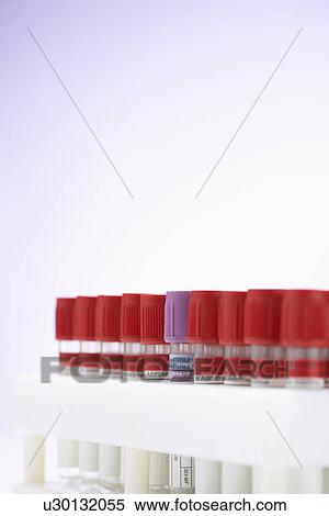 Stock Photography - Test tubes with red lids surrounding one with purple lid. Fotosearch