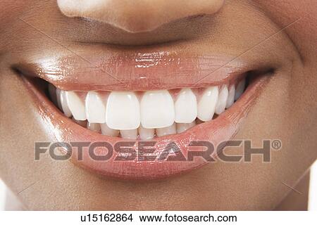Picture - Woman's open mouth perfect teeth. Fotosearch