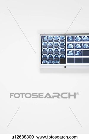 X-rays and ultra sound results hanging on wall View Large Photo Image Stock Image - X-rays and ultra sound results hanging on wall. Fotosearch