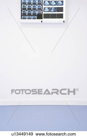 Stock Photo - X-rays and ultra sound results hanging on wall. Fotosearch