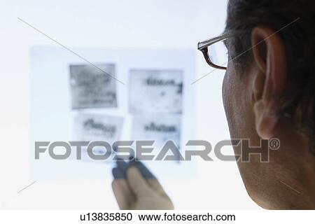 Stock Image - Scientist looking at Xray close up back view. Fotosearch