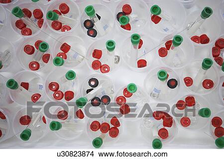 Picture - Tray full of speciman vials containing parasitic insects used in agricultural research. Fotosearch