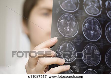 Female doctor holding CAT scan View Large Photo Image Stock Photo - Female doctor holding CAT scan. Fotosearch
