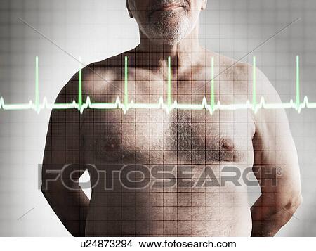 Picture - Life of a Patient. Fotosearch