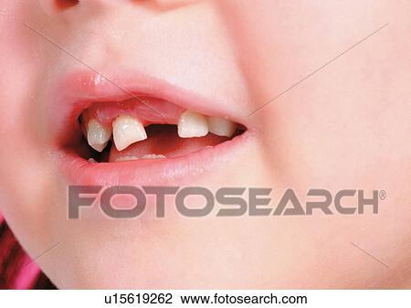 Stock Image - Chin, Close-Up, Facial Expression. Fotosearch