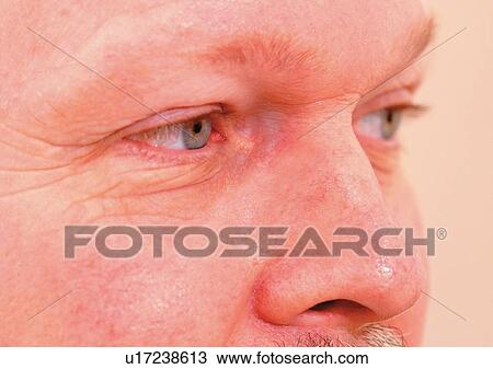 Stock Image - Close-Up, Cornea, Detail, Eye Lashes, Eyeball. Fotosearch