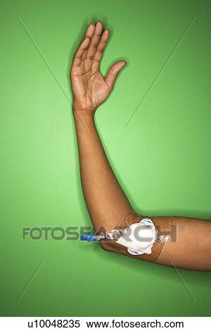 African-American female arm with bandage gauze and IV. View Large Photo Image Stock Photography - African-American female arm with bandage gauze and IV.. Fotosearch