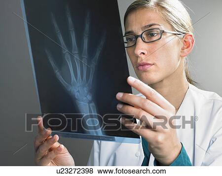 Female doctor looking at x ray of hand. View Large Photo Image Stock Photo - Female doctor looking at x ray of hand.. Fotosearch
