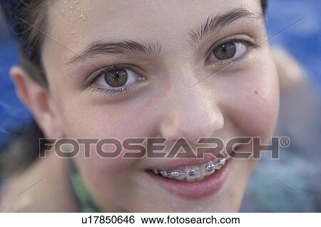 Stock Photograph - Young girl smiling with braces in swimming pool.. Fotosearch