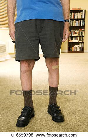 An elderly man wearing shorts View Large Photo Image Stock Photo - An elderly man wearing shorts. Fotosearch