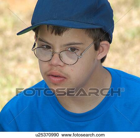Face of a man with disabilities. View Large Photo Image Stock Image - Face of a man with disabilities.. Fotosearch