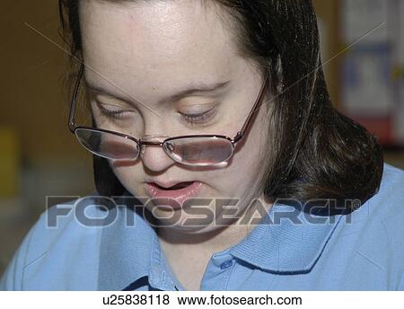 Stock Photo - Face of a woman with disabilities.. Fotosearch